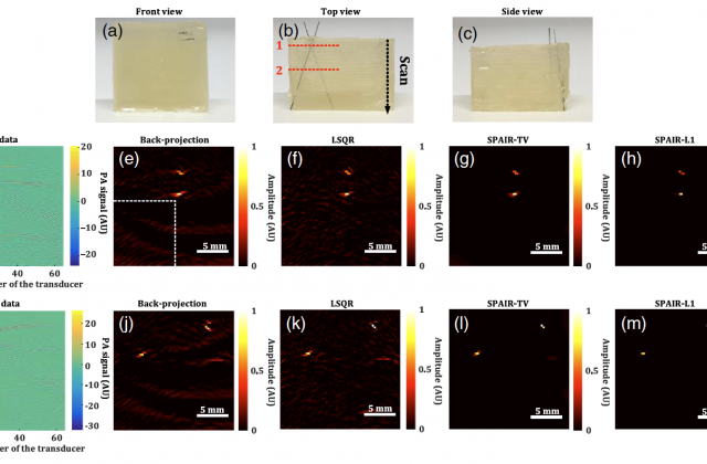 Experimental results on tissue-mimicking phantoms with two graphite inclusions. (a)–(c) 3-D perspectives of the tissue-mimicking phantom with two graphite inclusions, (d) experimentally collected RF data at the first scanning location in (b), (e) reconstructed IPD image from the back projection approach at the first scanning location in (b), (f) reconstructed IPD image from the LSQR approach at the first scanning location in (b), (g) reconstructed IPD image from SPAIR with TV regularization