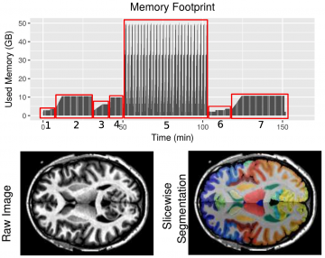 Example of a brain segmentation application that can be deployed more efficiently when modeling its walltime and memory footprint